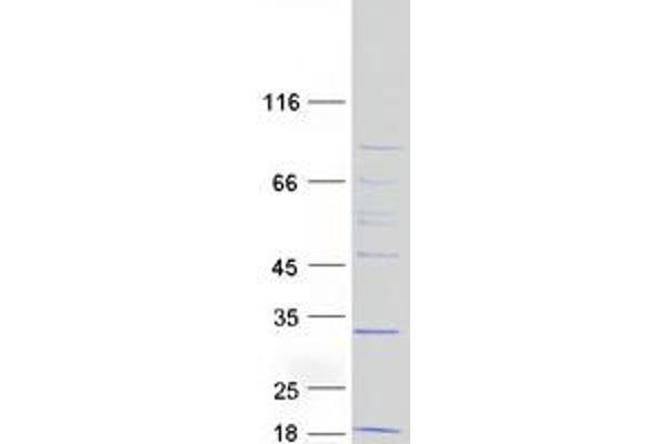 MRPL43 Protein (Transcript Variant 2) (Myc-DYKDDDDK Tag)