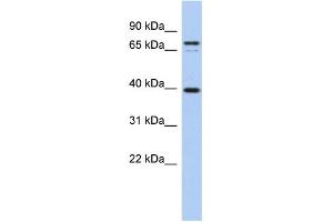 WB Suggested Anti-NYD-SP21 Antibody Titration:  0. (MS4A14 antibody  (Middle Region))