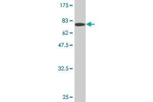 Western Blot detection against Immunogen (69. (ZFYVE19 antibody  (AA 1-396))