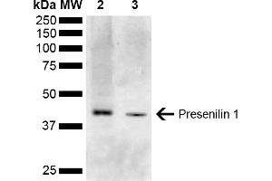 Western blot analysis of Mouse Kidney, Liver showing detection of ~52. (Presenilin 1 antibody  (AA 1-100) (HRP))