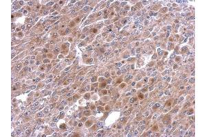 IHC-P Image TNFalpha-IP 2 antibody [C1C3] detects TNFalpha-IP 2 protein at cytosol on HeLa xenograft by immunohistochemical analysis. (TNIP2 antibody  (Center))