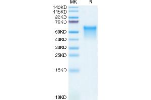 Mouse GPVI on Tris-Bis PAGE under reduced condition. (GP6 Protein (AA 22-265) (His tag))