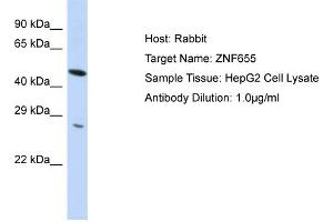 Host:  Rabbit  Target Name:  ZNF655  Sample Type:  HepG2 Whole Cell lysates  Antibody Dilution:  1.