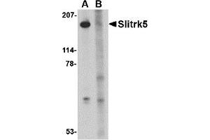 Western Blotting (WB) image for anti-SLIT and NTRK-Like Family, Member 5 (SLITRK5) (Middle Region 2) antibody (ABIN1031202) (SLITRK5 antibody  (Middle Region 2))
