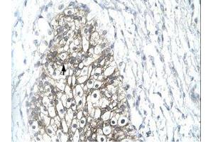 Image no. 1 for anti-Matrix Metallopeptidase 19 (MMP19) (AA 349-398) antibody (ABIN202685) (MMP19 antibody  (AA 349-398))