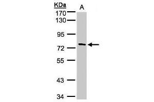 WB Image Sample(30 ug whole cell lysate) A:A431, 7. (TTC30A antibody)