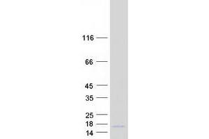 Validation with Western Blot (LCE3D Protein (Myc-DYKDDDDK Tag))