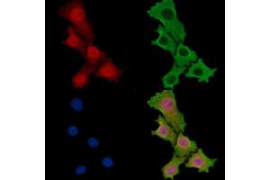 DHX32 Antibody staining HepG2 cells by IF/ICC.