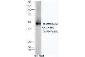 Mouse heart lysates probed with Rabbit Anti-GSK3 alpha/beta (Tyr279+Tyr216) Polyclonal Antibody, Unconjugated (ABIN677243) at 1:300 overnight at 4˚C. (GSK3 alpha/beta antibody  (pTyr216, pTyr279))