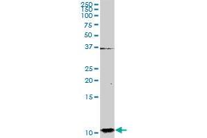 S100A2 MaxPab rabbit polyclonal antibody. (S100A2 antibody  (AA 1-97))