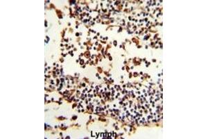 Immunohistochemistry (IHC) image for anti-Immunoglobulin Heavy Constant alpha 1 (IGHA1) antibody (ABIN3003223) (IGHA1 antibody)