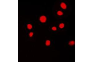 Immunofluorescent analysis of ATRIP staining in MCF7 cells. (ATRIP antibody  (N-Term))