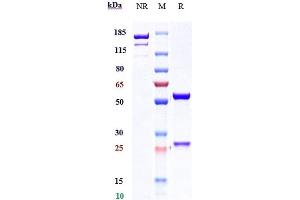 Anti-IL-22 Reference Antibody (fezakinumab) on SDS-PAGE under reducing (R) condition. (Recombinant IL22 (Fezakinumab Biosimilar) antibody)