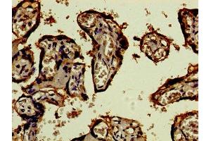 Immunohistochemistry of paraffin-embedded human placenta tissue using ABIN7159320 at dilution of 1:100 (CD46 antibody  (AA 164-325))