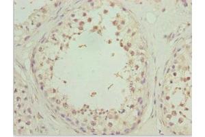 Immunohistochemistry of paraffin-embedded human testis tissue using ABIN7176149 at dilution of 1:100 (ZNF2 antibody  (AA 1-200))
