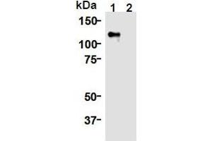 Western Blotting (WB) image for anti-Kinesin Family Member 11 (KIF11) (AA 1-1056), (N-Term) antibody (ABIN1449288) (KIF11 antibody  (N-Term))