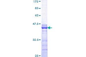 CBP Protein (AA 951-1050) (GST tag)