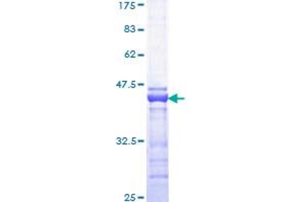 CBP Protein (AA 951-1050) (GST tag)