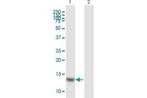 Western Blot analysis of HOPX expression in transfected 293T cell line ( H00084525-T01 ) by HOPX MaxPab polyclonal antibody.