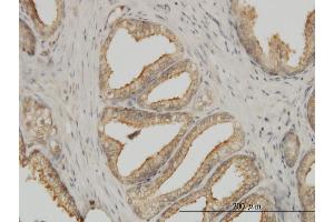 Immunoperoxidase of monoclonal antibody to TUBA1B on formalin-fixed paraffin-embedded human prostate. (TUBA1B antibody  (AA 1-451))