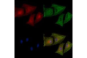 Phospho-IP3 Receptor (Ser1764) Antibody staining A549 cells(heat shock treatment) by IF/ICC.