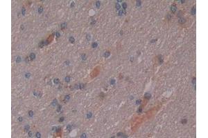 DAB staining on IHC-P; Samples: Human Cerebrum Tissue (Osteopontin antibody  (AA 18-314))