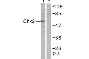 Western blot analysis of extracts from 293 cells untreated or treated with UV, using Chk2 (Ab-516) antibody (#B7043, Linand 2). (CHEK2 antibody)