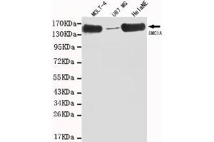 Western blot detection of SMC1A(C-term) in MOLT-4,U87 MG and HelaNE cell lysates using SMC1A (N-terminus) mouse mAb (1:1000 diluted). (SMC1A antibody  (C-Term))