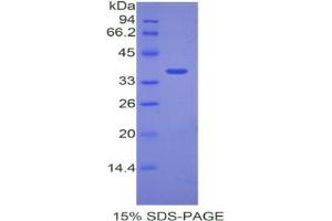 SDS-PAGE analysis of Mouse ANGPTL7 Protein. (ANGPTL7 Protein)
