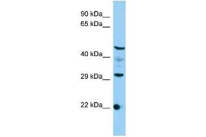 Host: Rabbit Target Name: C3orf26 Sample Type: HepG2 Whole Cell lysates Antibody Dilution: 1. (CMSS1 antibody  (N-Term))