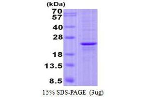 Image no. 1 for FGFR1OP N-Terminal Like (FOPNL) protein (His tag) (ABIN1098378) (FOPNL Protein (His tag))