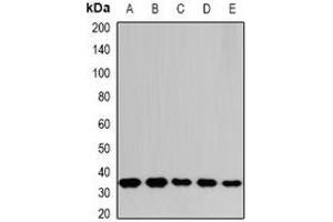 Western blot analysis of THOC1 expression in SHSY5Y (A), SW620 (B), NIH3T3 (C), mouse spleen (D), rat liver (E) whole cell lysates. (THOC1 antibody)
