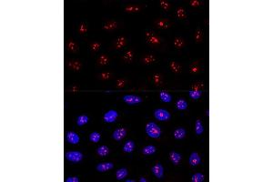 Immunofluorescence (IF) image for anti-Myb-Binding Protein 1A (MYBBP1A) (AA 1104-1328) antibody (ABIN1680938)