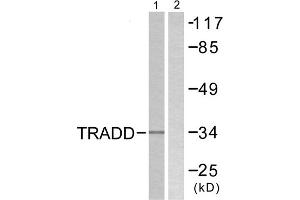 Western blot analysis of extracts from COS7 cells, using TRADD antibody. (TRADD antibody  (C-Term))