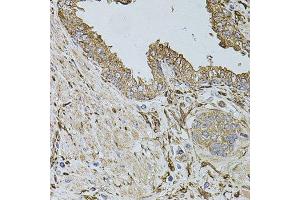 Immunohistochemistry of paraffin-embedded human prostate using ALDH1A1 antibody.