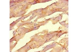Immunohistochemistry of paraffin-embedded human skeletal muscle tissue using ABIN7162415 at dilution of 1:100 (NR1H2 antibody  (AA 1-461))