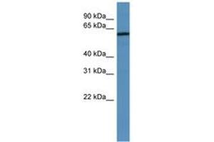 Image no. 1 for anti-Melanoma Antigen Family D, 2 (MAGED2) (AA 67-116) antibody (ABIN6746701)