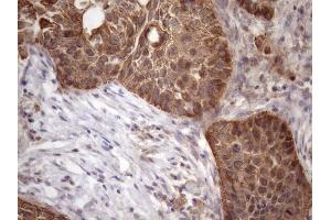 Immunohistochemistry (IHC) image for anti-Amelotin (AMTN) antibody (ABIN2716038)