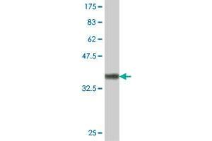 Western Blot detection against Immunogen (37 KDa) . (TSEN54 antibody  (AA 427-525))