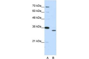 WB Suggested Anti-PSMA1 Antibody Titration:  1. (PSMA1 antibody  (N-Term))