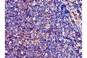 Immunohistochemistry (IHC) image for anti-Integrin beta 1 (ITGB1) (AA 297-380) antibody (ABIN7147139)