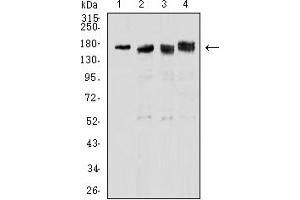 Western Blotting (WB) image for anti-Topoisomerase (DNA) II alpha 170kDa (TOP2A) (AA 1100-1530) antibody (ABIN7193564)