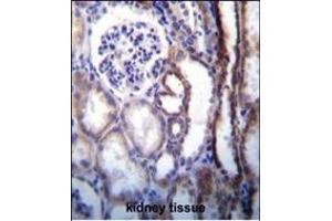 ATP6V1B1 Antibody (Center) (ABIN655485 and ABIN2845006) immunohistochemistry analysis in formalin fixed and paraffin embedded human kidney tissue followed by peroxidase conjugation of the secondary antibody and DAB staining. (ATP6V1B1 antibody  (AA 284-310))