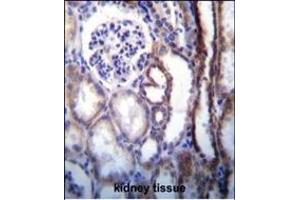 ATP6V1B1 Antibody (Center) (ABIN655485 and ABIN2845006) immunohistochemistry analysis in formalin fixed and paraffin embedded human kidney tissue followed by peroxidase conjugation of the secondary antibody and DAB staining. (ATP6V1B1 antibody  (AA 284-310))