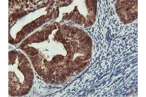 Image no. 1 for anti-CoA Synthase (COASY) antibody (ABIN1497556) (COASY antibody)