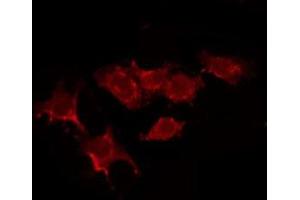 ABIN6278599 staining Hela by IF/ICC. (NTSR2 antibody  (Internal Region))