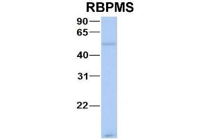 Host:  Rabbit  Target Name:  CHAD  Sample Type:  Human Adult Placenta  Antibody Dilution:  1. (RBPMS antibody  (N-Term))