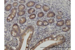 Immunoperoxidase of monoclonal antibody to TYK2 on formalin-fixed paraffin-embedded human small Intestine. (TYK2 antibody  (AA 276-375))