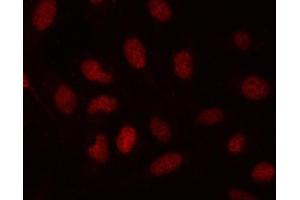 IF analysis of SDE2 using anti-SDE2 antibody (ABIN7599603). (C1orf55 antibody  (AA 10-447))