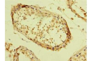 Immunohistochemistry of paraffin-embedded human testis tissue using ABIN7175978 at dilution of 1:100 (ZBTB32 antibody  (AA 1-294))